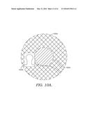 Marking And Tracking An Area Of Interest During Endoscopy diagram and image