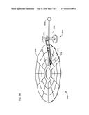 TOPOGRAPHIC FEEDFORWARD SYSTEM diagram and image