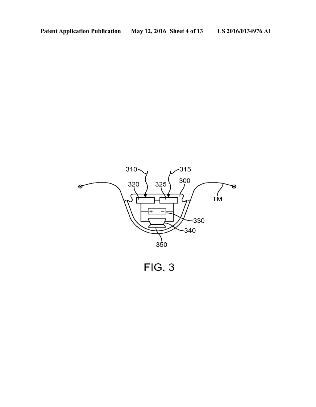 OPTICAL ELECTRO-MECHANICAL HEARING DEVICES WITH SEPARATE POWER AND SIGNAL     COMPONENTS - diagram, schematic, and image 05