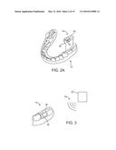 METHODS AND APPARATUS FOR PROCESSING AUDIO SIGNALS diagram and image