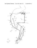 SLEEVE WITH EXTERNAL ASSISTANCE DURING AN ARM MOTION diagram and image