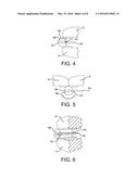 Expandable Chair diagram and image