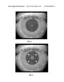 Methods for Objectively Determining the Visual Axis of the Eye and     Measuring Its Refraction diagram and image