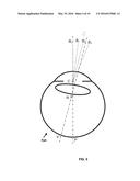 Methods for Objectively Determining the Visual Axis of the Eye and     Measuring Its Refraction diagram and image