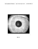 Methods for Objectively Determining the Visual Axis of the Eye and     Measuring Its Refraction diagram and image