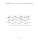 METHODS AND SYSTEMS FOR POWER OPTIMIZATION IN A MEDICAL DEVICE diagram and image