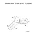 DEVICE FEATURES AND DESIGN ELEMENTS FOR LONG-TERM ADHESION diagram and image