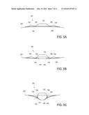 DEVICE FEATURES AND DESIGN ELEMENTS FOR LONG-TERM ADHESION diagram and image