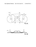 DEVICE FEATURES AND DESIGN ELEMENTS FOR LONG-TERM ADHESION diagram and image