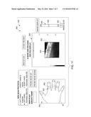 FINGER JOINT ULTRASOUND IMAGING diagram and image