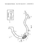 PERCUTANEOUS CORONARY INTERVENTION (PCI) PLANNING INTERFACE AND ASSOCIATED     DEVICES, SYSTEMS, AND METHODS diagram and image