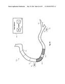 PERCUTANEOUS CORONARY INTERVENTION (PCI) PLANNING INTERFACE AND ASSOCIATED     DEVICES, SYSTEMS, AND METHODS diagram and image