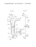 TISSUE RETRACTOR APPARATUS AND METHODS diagram and image