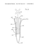 TISSUE RETRACTOR APPARATUS AND METHODS diagram and image