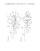 TISSUE RETRACTOR APPARATUS AND METHODS diagram and image