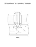 SYSTEMS, METHODS, AND DEVICES FOR CLOSING HOLES IN BODY LUMENS diagram and image