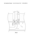 SYSTEMS, METHODS, AND DEVICES FOR CLOSING HOLES IN BODY LUMENS diagram and image