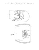 Occluder and Anastomosis Devices diagram and image