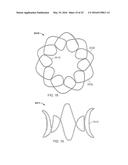 Occluder and Anastomosis Devices diagram and image