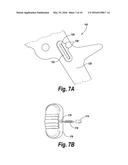 Adjustable Rongeur diagram and image