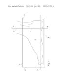 SOFT TISSUE RECONSTRUCTION diagram and image