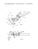 SOFT TISSUE RECONSTRUCTION diagram and image