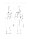 SOFT TISSUE RECONSTRUCTION diagram and image