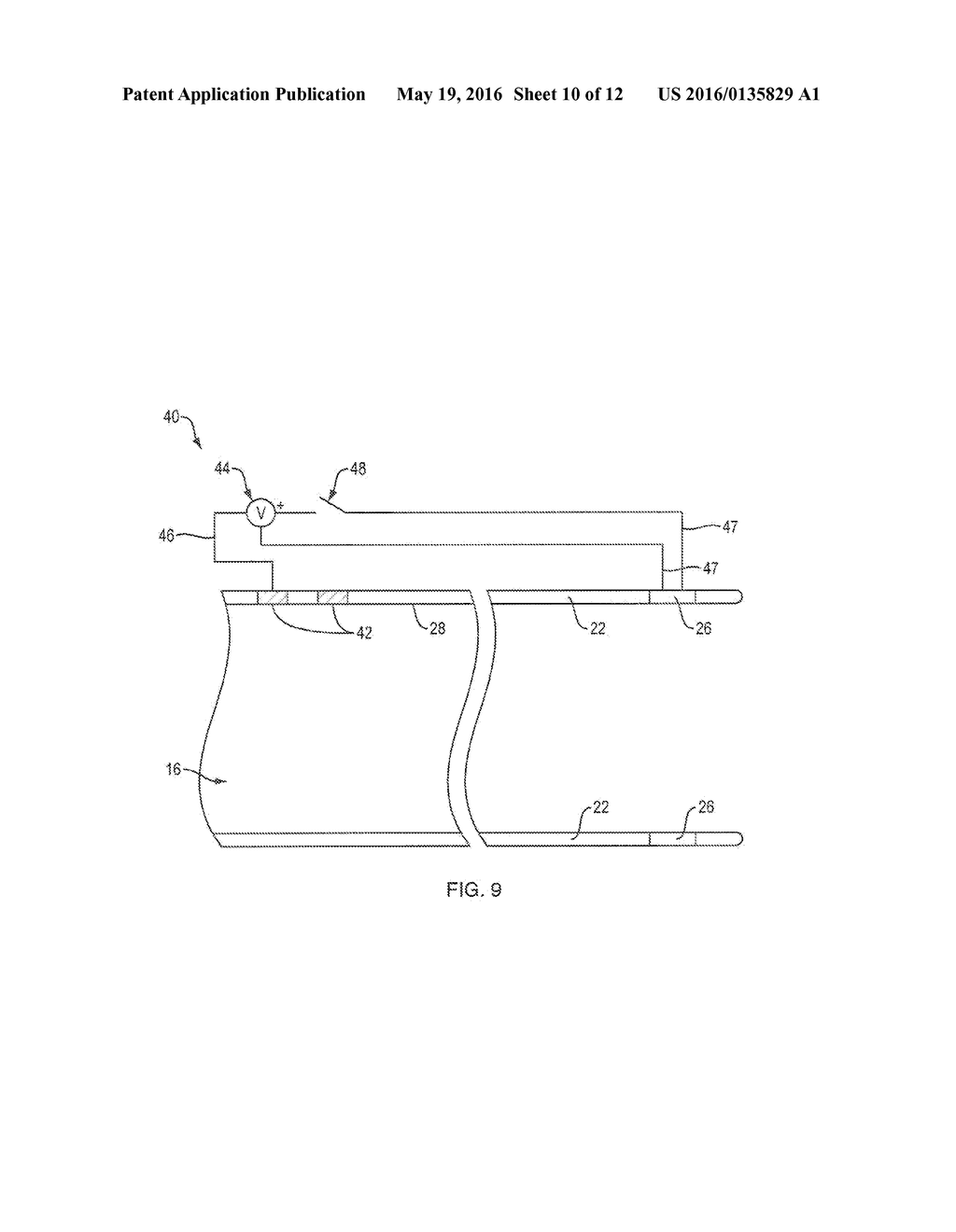 SYSTEMS AND METHODS FOR EN BLOC REMOVAL OF UNDESIRABLE MATERIAL FROM     PASSAGEWAYS - diagram, schematic, and image 11