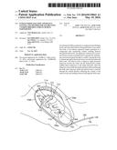 INTRAUTERINE BALLOON APPARATUS, SYSTEM, AND METHOD FOR AUGMENTING UTERINE     BIRTHING FORCES DURING PARTURITION diagram and image