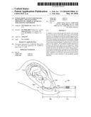 INTRAUTERINE ACCESS CATHETER FOR DELIVERING AND FACILITATING OPERATION OF     A MEDICAL APPARATUS FOR ASSISTING PARTURITION diagram and image