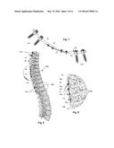 GROWING SPINAL RODS AND PEDICLE SCREWS FOR SECURING MULTIPLE SPINAL RODS diagram and image