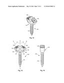 GROWING SPINAL RODS AND PEDICLE SCREWS FOR SECURING MULTIPLE SPINAL RODS diagram and image