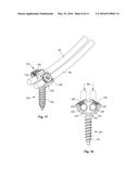 GROWING SPINAL RODS AND PEDICLE SCREWS FOR SECURING MULTIPLE SPINAL RODS diagram and image