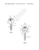 GROWING SPINAL RODS AND PEDICLE SCREWS FOR SECURING MULTIPLE SPINAL RODS diagram and image