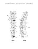 GROWING SPINAL RODS AND PEDICLE SCREWS FOR SECURING MULTIPLE SPINAL RODS diagram and image