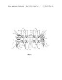 SPINAL IMPLANT SYSTEM AND METHOD diagram and image