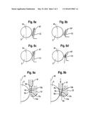 RECEIVING PART FOR RECEIVING A ROD FOR COUPLING THE ROD TO A BONE     ANCHORING ELEMENT diagram and image