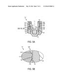 Locking Compression Members for Use With Bone Anchor Assemblies and     Methods diagram and image