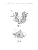 Locking Compression Members for Use With Bone Anchor Assemblies and     Methods diagram and image