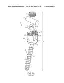 BONE ANCHORS AND SURGICAL INSTRUMENTS WITH INTEGRATED GUIDE TIPS diagram and image