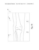 APPARATUS AND METHOD FOR CALIBRATING AN X-RAY IMAGE OF A KNEE OF A PATIENT diagram and image