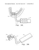 SYSTEM AND METHOD FOR REAL TIME TRACKING AND MODELING OF SURGICAL SITE diagram and image