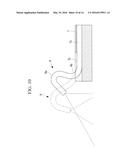 TREATMENT MANIPULATOR AND MANIPULATOR SYSTEM diagram and image