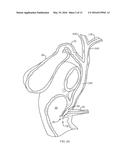 BILIARY STENTS AND METHODS diagram and image