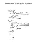 LOW PROFILE HEART VALVE AND DELIVERY SYSTEM diagram and image