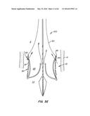 LOW PROFILE HEART VALVE AND DELIVERY SYSTEM diagram and image