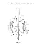 LOW PROFILE HEART VALVE AND DELIVERY SYSTEM diagram and image