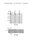 LOW PROFILE HEART VALVE AND DELIVERY SYSTEM diagram and image