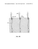 LOW PROFILE HEART VALVE AND DELIVERY SYSTEM diagram and image