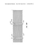 LOW PROFILE HEART VALVE AND DELIVERY SYSTEM diagram and image